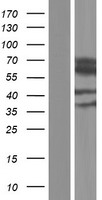 CES2 Human Over-expression Lysate