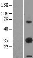 EBAG9 Human Over-expression Lysate