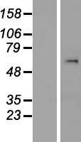 SMYD1 Human Over-expression Lysate