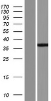 LYSMD3 Human Over-expression Lysate