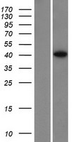 SPO11 Human Over-expression Lysate