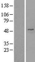 UBE1C (UBA3) Human Over-expression Lysate