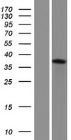ASB7 Human Over-expression Lysate