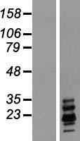 Ribonuclease A (RNASE1) Human Over-expression Lysate