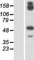GBP6 Human Over-expression Lysate