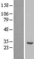 RPL7L1 Human Over-expression Lysate
