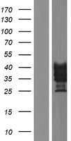 VSTM1 Human Over-expression Lysate