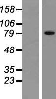 ZNF615 Human Over-expression Lysate