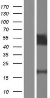 TPRX1 Human Over-expression Lysate