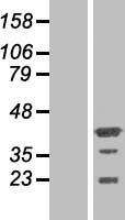 PHF20L1 Human Over-expression Lysate