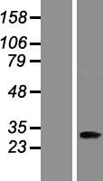 ANKRD45 Human Over-expression Lysate