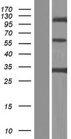 CLEC4G Human Over-expression Lysate
