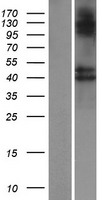 B3GNT8 Human Over-expression Lysate