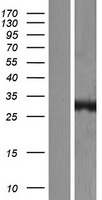 CA13 Human Over-expression Lysate