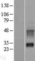 KRTAP10-1 Human Over-expression Lysate