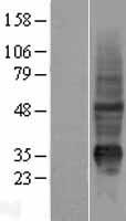 KRTAP10-7 Human Over-expression Lysate