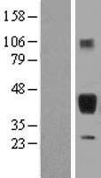 SFTPB Human Over-expression Lysate