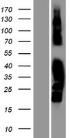 MAST4 Human Over-expression Lysate