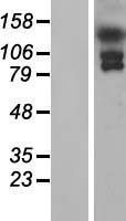 EFCAB6 Human Over-expression Lysate