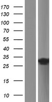 TRIM50C (TRIM74) Human Over-expression Lysate