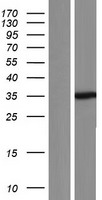 SETD3 Human Over-expression Lysate