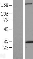 Nucleophosmin (NPM1) Human Over-expression Lysate