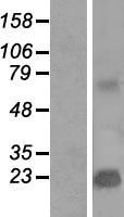 TMEPAI (PMEPA1) Human Over-expression Lysate