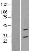 ADPRHL1 Human Over-expression Lysate