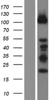 DZIP1 Human Over-expression Lysate