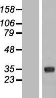 COLEC11 Human Over-expression Lysate