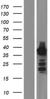 HOMER2 Human Over-expression Lysate