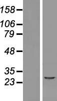 NACA2 Human Over-expression Lysate