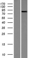 NEK5 Human Over-expression Lysate