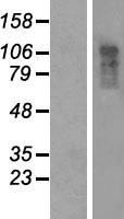 CCDC80 Human Over-expression Lysate