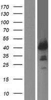 ZNF365 Human Over-expression Lysate