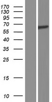 Spastin (SPAST) Human Over-expression Lysate
