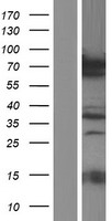 PRC1 Human Over-expression Lysate
