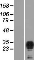 TPD52L2 Human Over-expression Lysate
