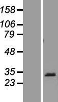 PRB1 Human Over-expression Lysate