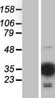 MOBKL2C (MOB3C) Human Over-expression Lysate