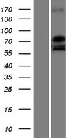 USP51 Human Over-expression Lysate