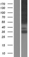 MPRIP Human Over-expression Lysate