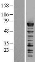 splicing factor 1 (SF1) Human Over-expression Lysate