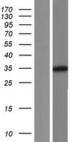 GLYAT Human Over-expression Lysate