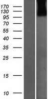 USP33 Human Over-expression Lysate