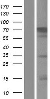 CACNB2 Human Over-expression Lysate