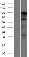 SEZ6L2 Human Over-expression Lysate
