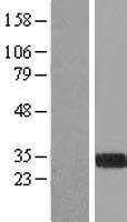 FGL1 Human Over-expression Lysate