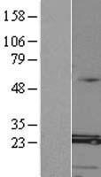 MED8 Human Over-expression Lysate