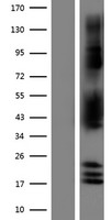 NDRG2 Human Over-expression Lysate